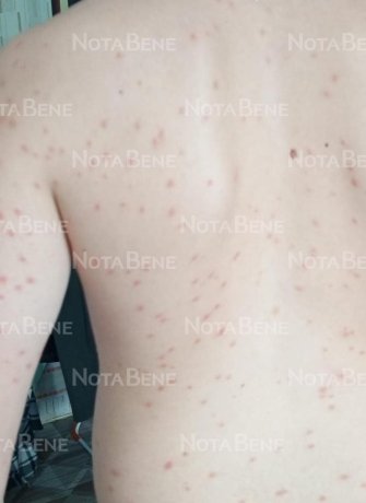 Фото: NotaBene