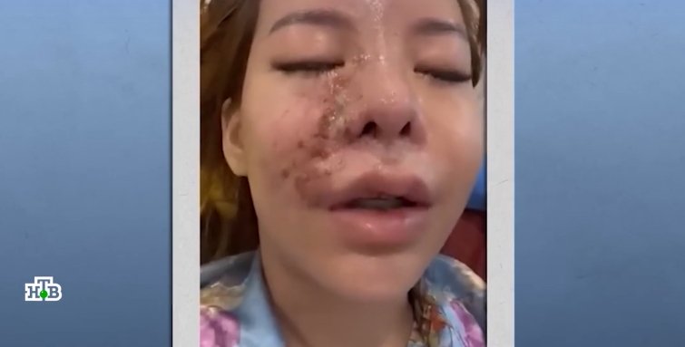 Фото: Стопкадр видео НТВ, репортер Татьяна Проскурякова