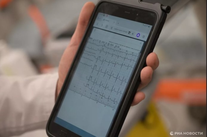 Фото: РИА Новости / Евгений Биятов Расшифровка ЭКГ. Архивное фото