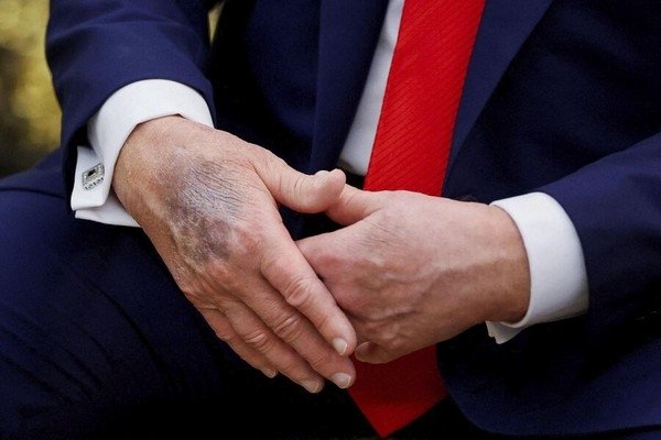 Brian Snyder/Reuters