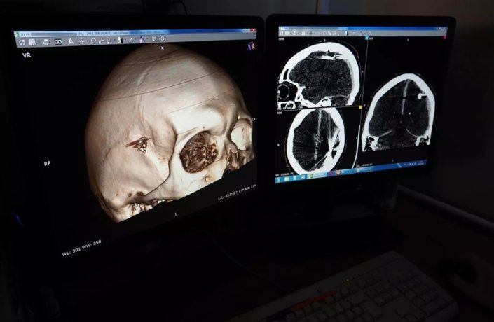 Фото : КГБУЗ ККБСМП Барнаул/ВКонтакте