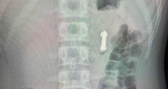  Фото : Министерство здравоохранения Московской области