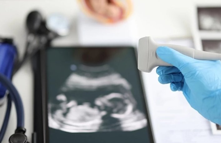 Фото: istockphoto.com