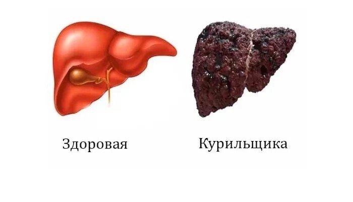 Фото: Минздрав Хакасии